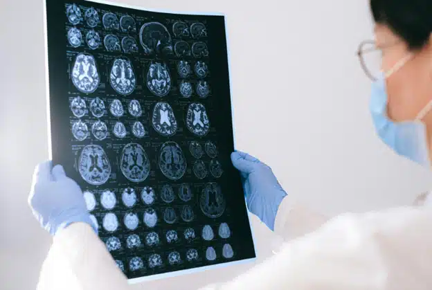 Understanding Alzheimer’s Disease and the Importance of Brain Awareness Month
